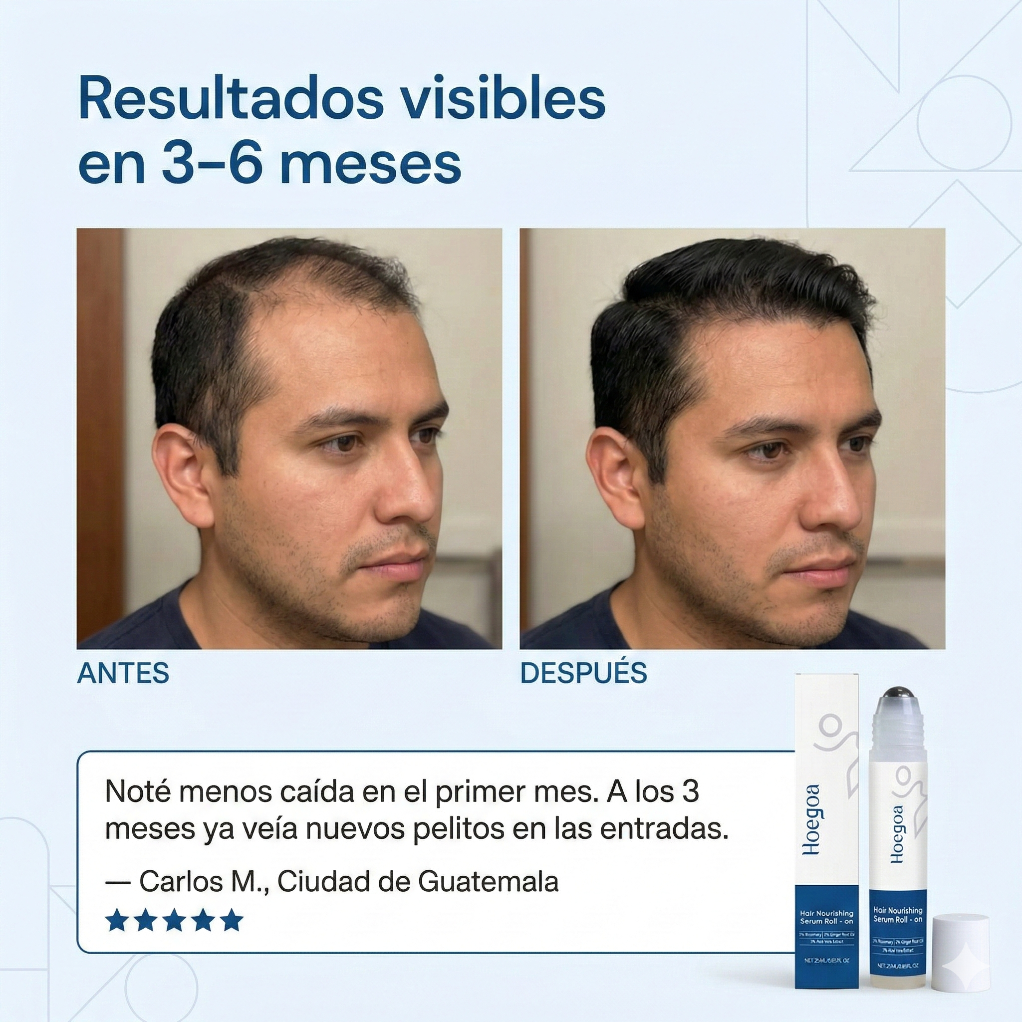 RollaGrow™ — Suero Roll-On Para Detener La Caída Del Cabello 2x1